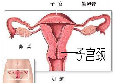 引发宫颈癌的危险因素有哪些？